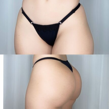 FIO BEATRIZ FLOR - Preto, G