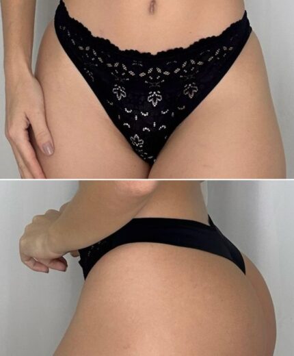 FIO FRENTE DE RENDA - Preto, G